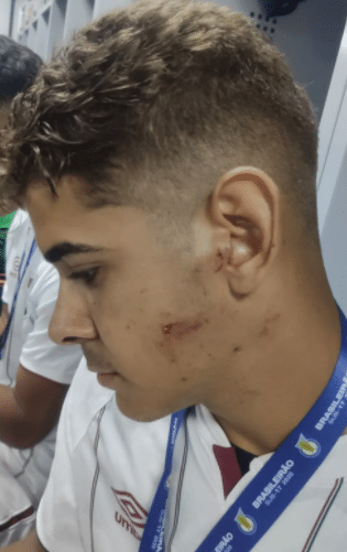 Desfecho da briga do Sub-17 est&aacute; pr&oacute;ximo