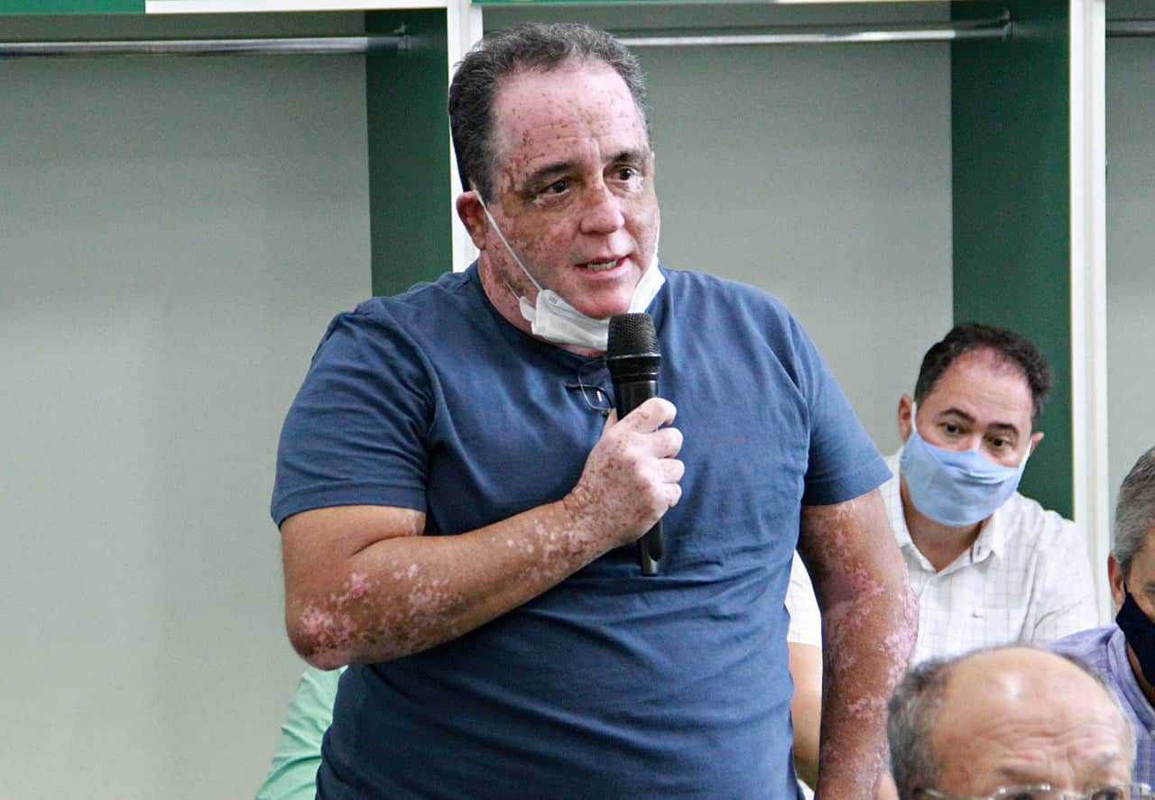 Luxa e Ceni? Edminho abre o jogo sobre negocia&ccedil;&otilde;es antes de fechar com Cabo!