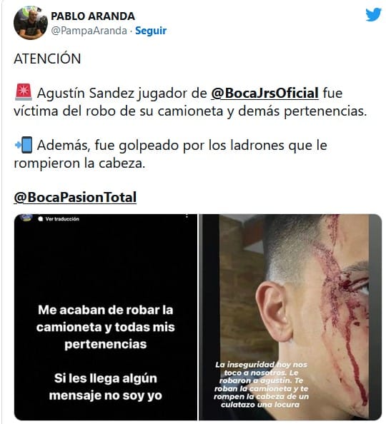 Ato de vandalismo contra jogador do Boca Juniors